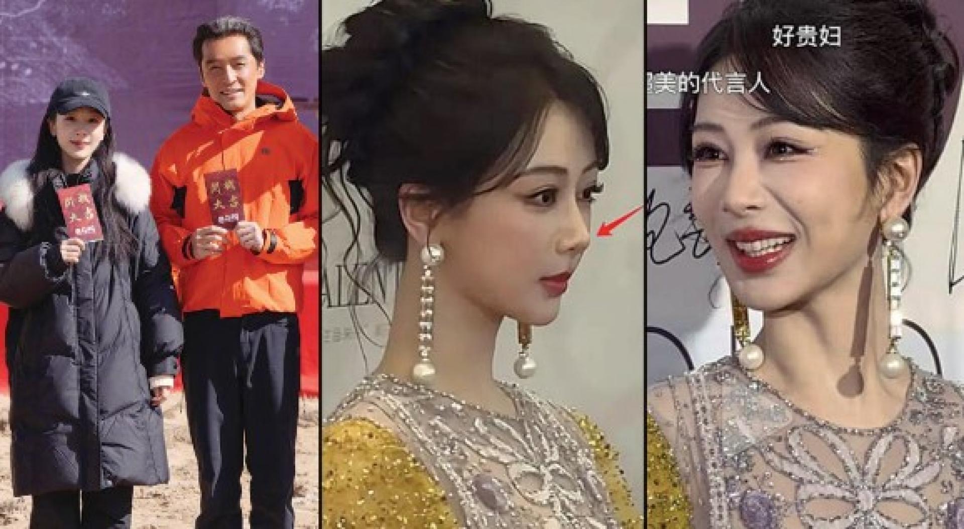 杨紫北影节生图曝光，笑起来脸部僵硬，法令纹怪异，且鼻子又窄又翘，被质疑整形过度，导致与胡歌的新剧《生命树》被看衰。