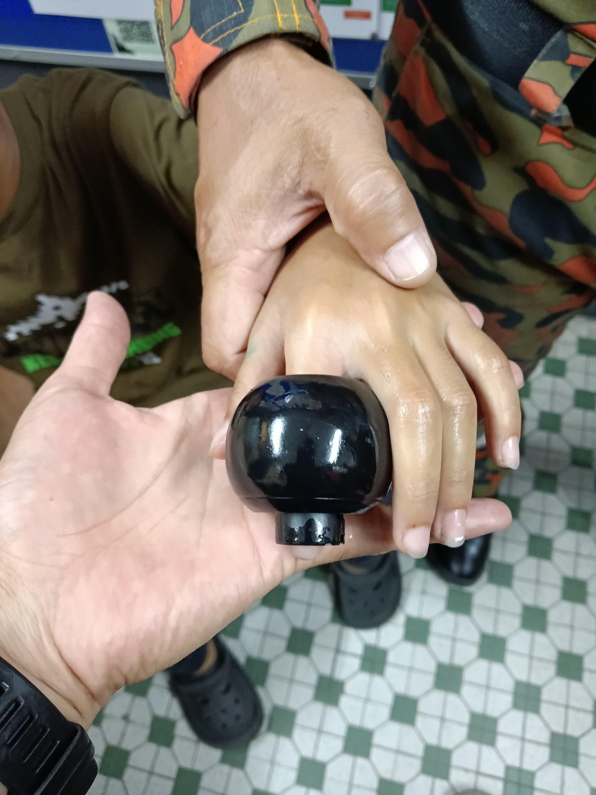 男童的左手食指被门锁按钮卡住。