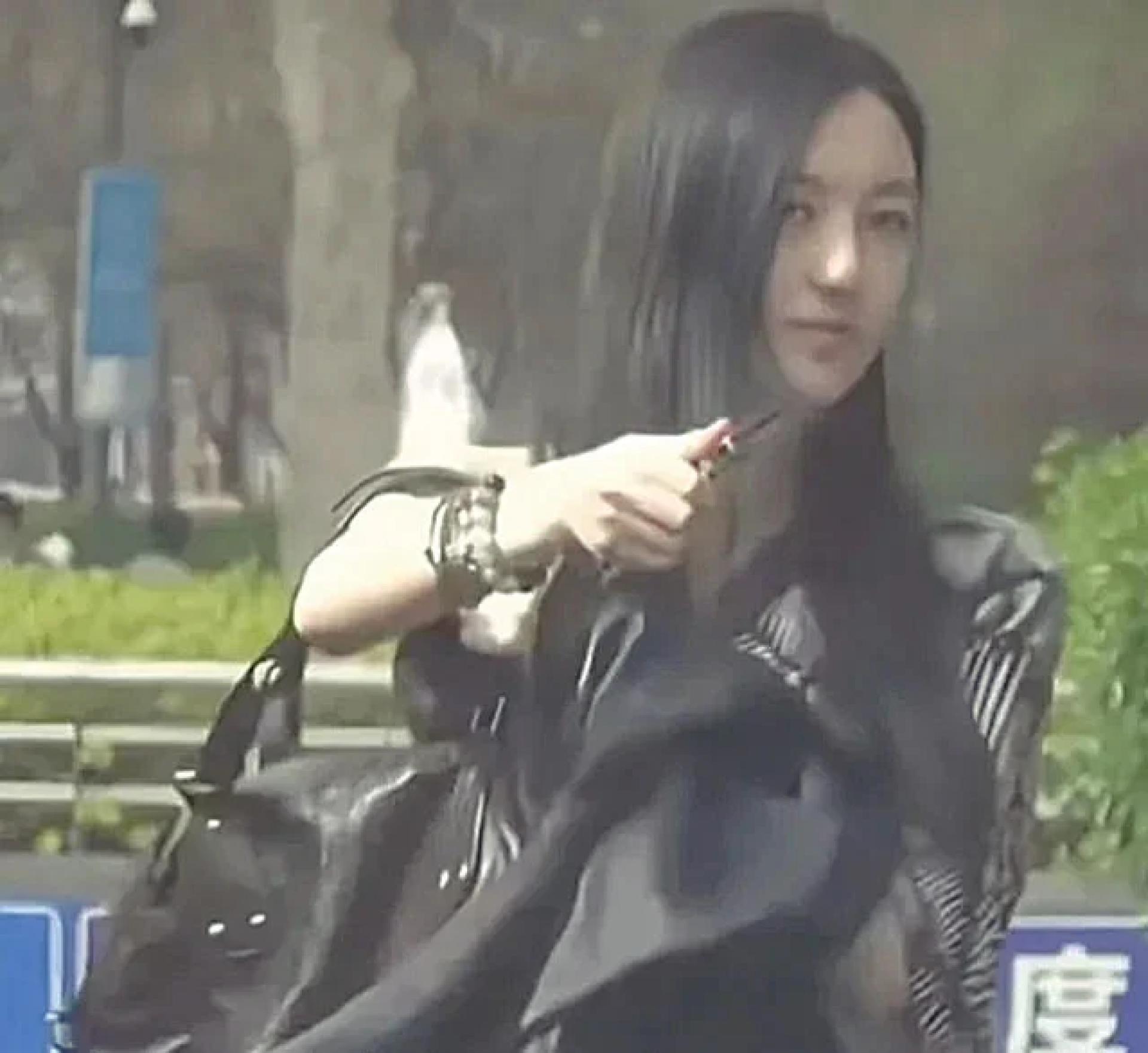李嫣经历4次兔唇手术，现在愈来愈漂亮。
