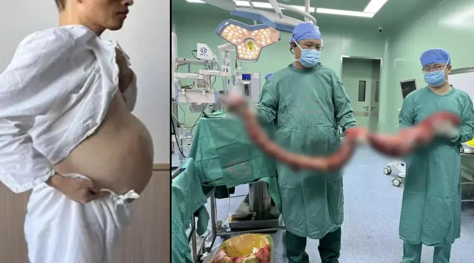 方先生坦言，过去几个月自己什么东西都吃不了，只能饮水和喝汤，体重瘦到只剩60多斤，于是紧急到医院治疗。