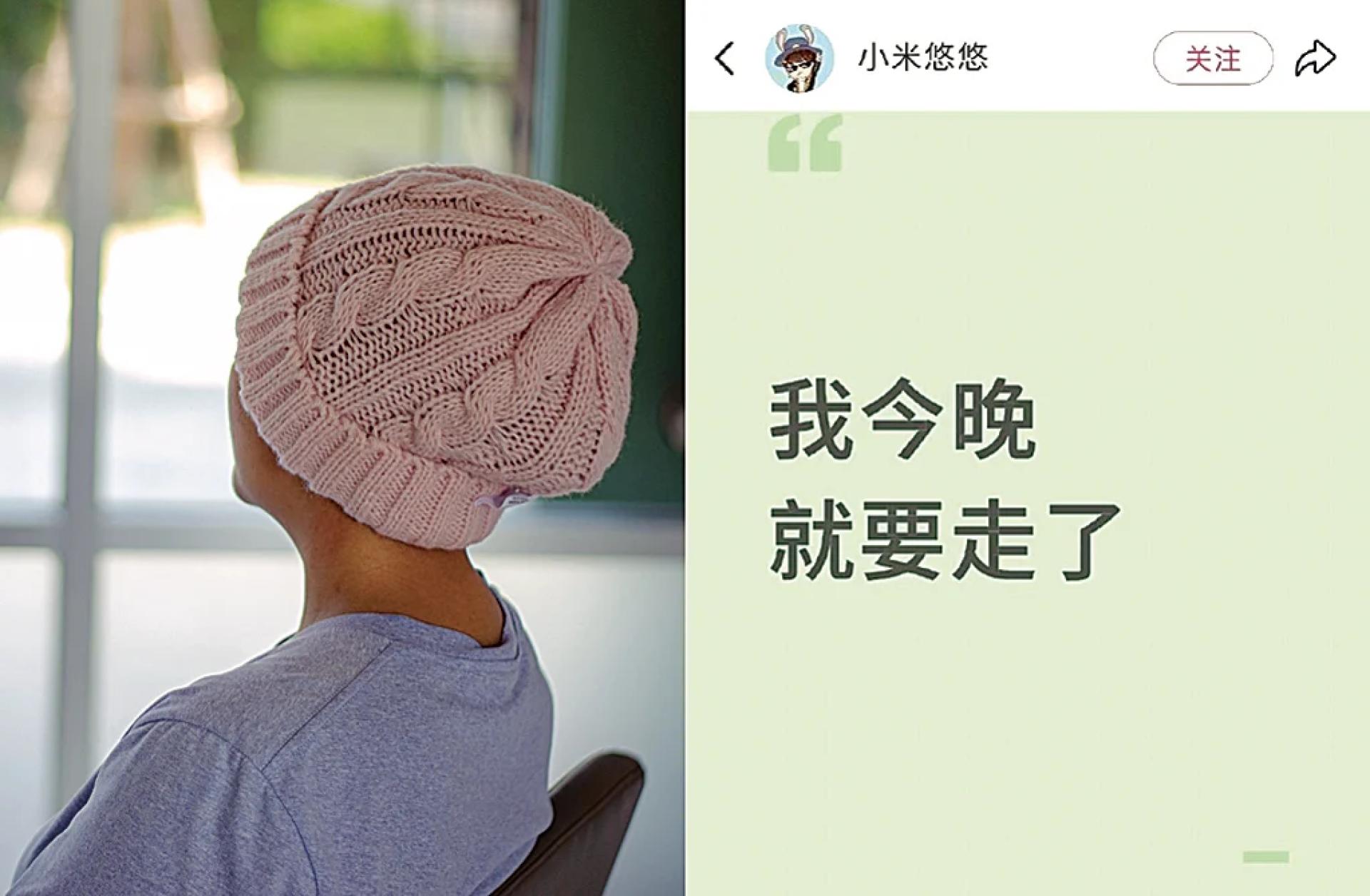 中国网红小米悠悠罹患卵巢癌过世，图为示意图，与当事人无关。