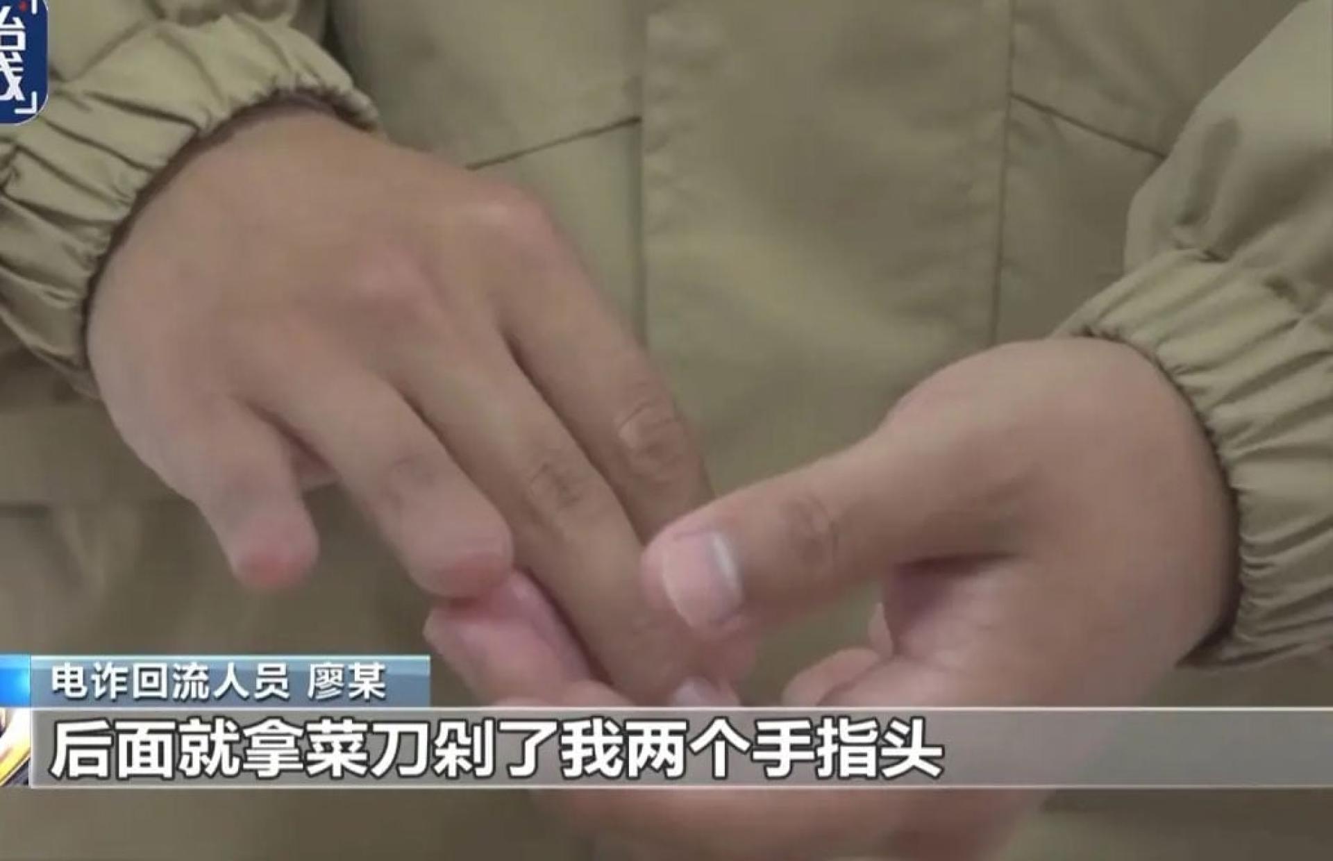 男子被菜刀剁了两个手指头。（央视新闻截图）