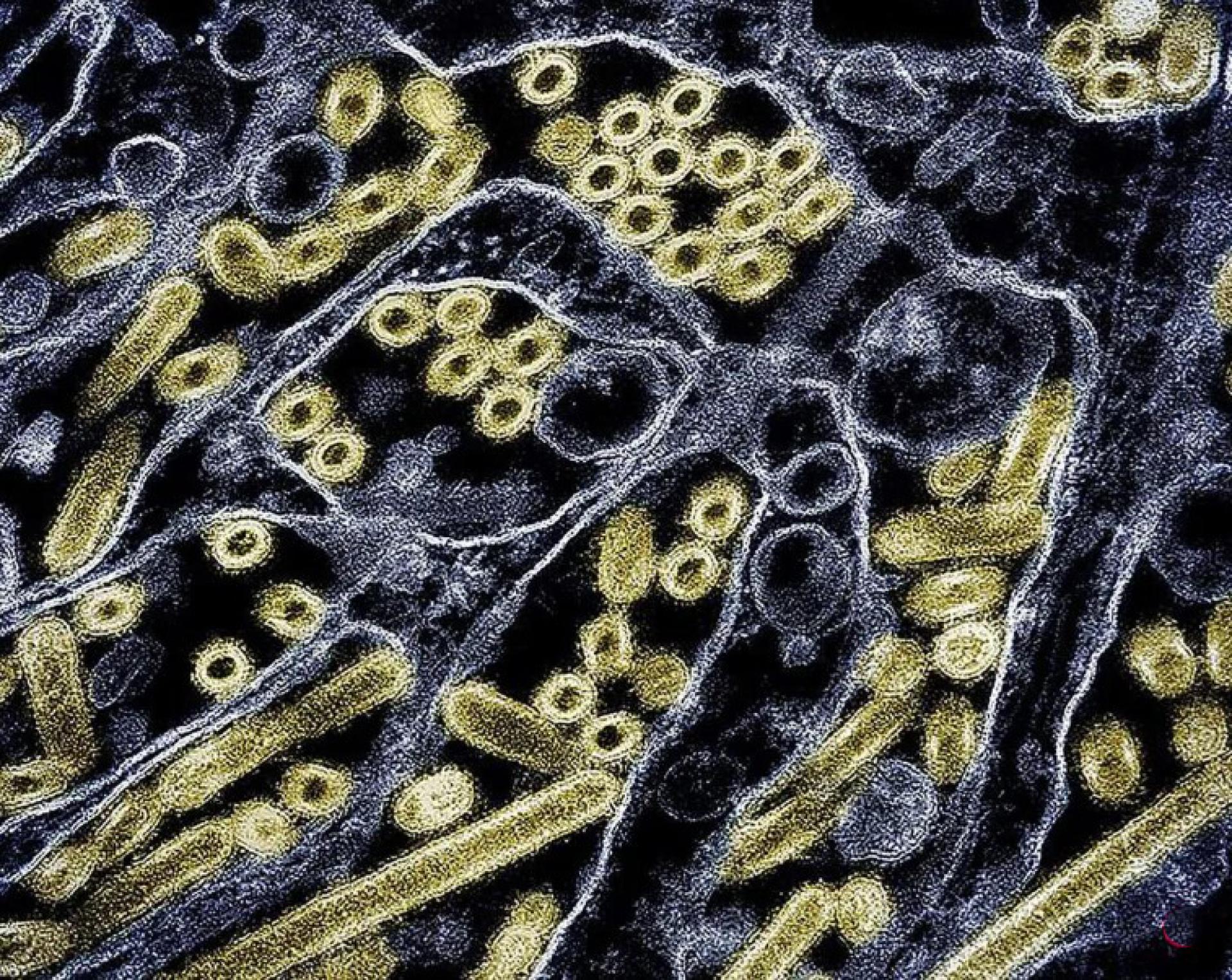 美国疾病控制与预防中心（CDC）说，甲型H3N2亚型流感病毒是本流感季最主要的流行毒株。 （档案照片）