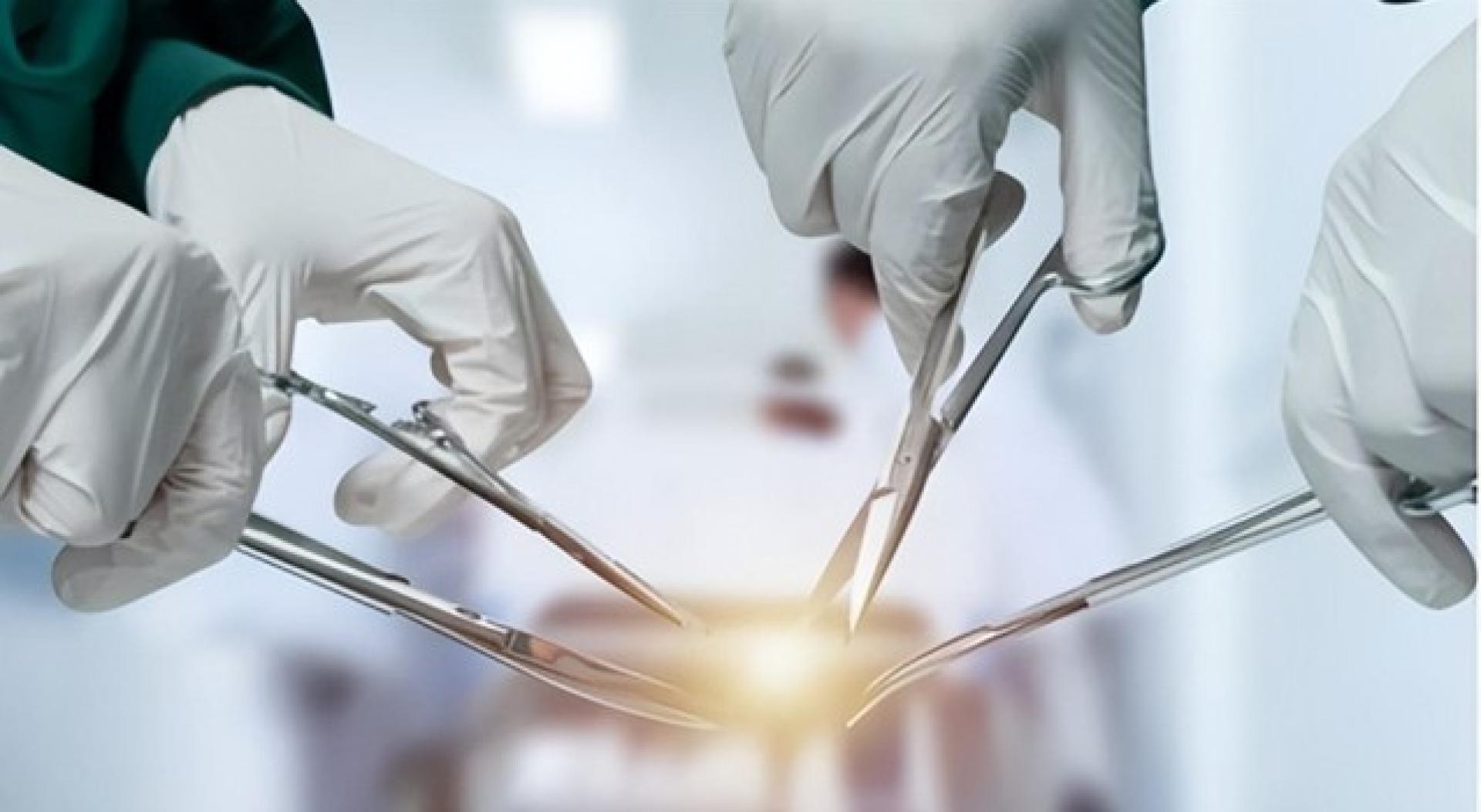 示意图。