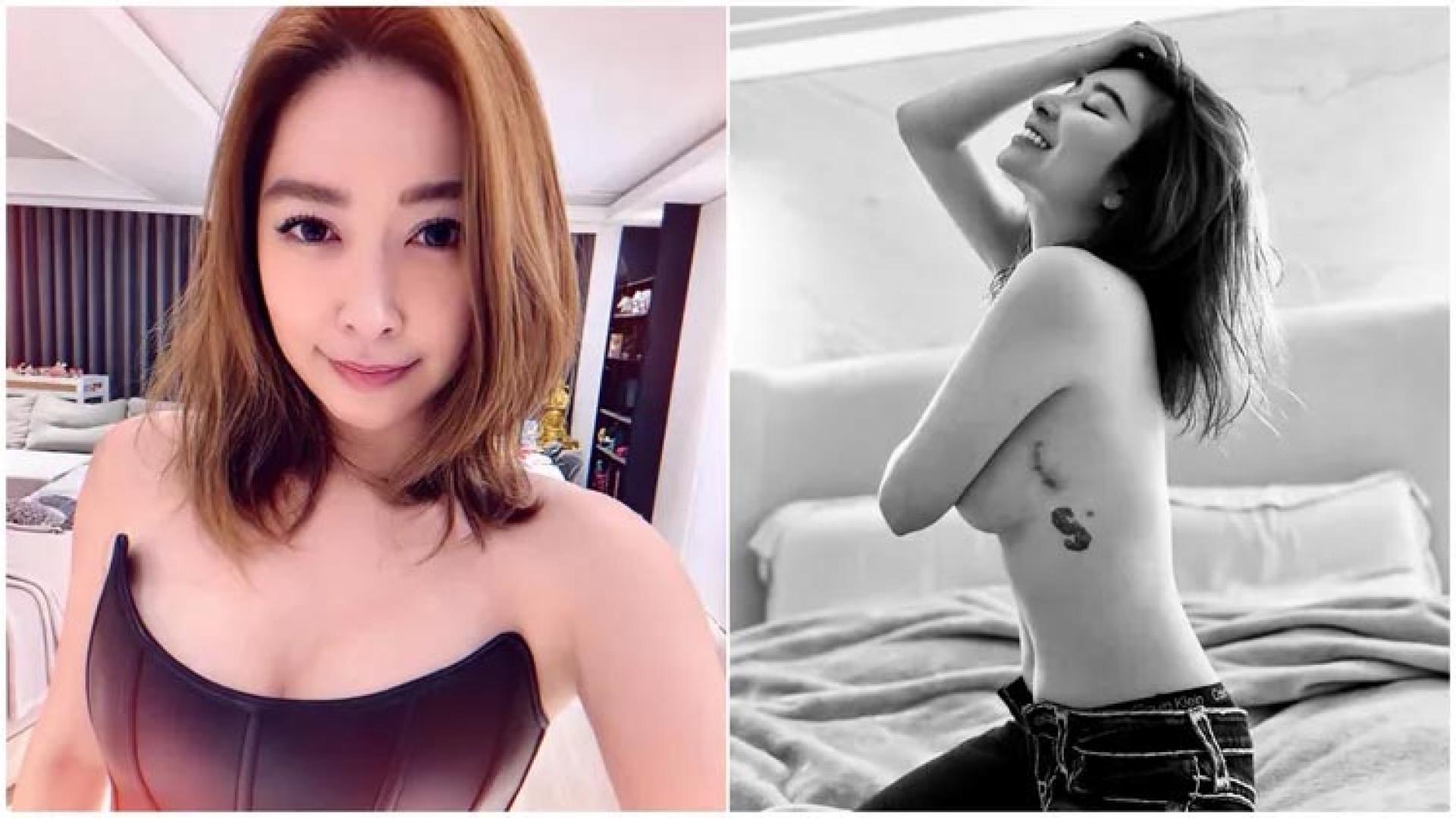 许维恩分享乳癌手术后心路历程。