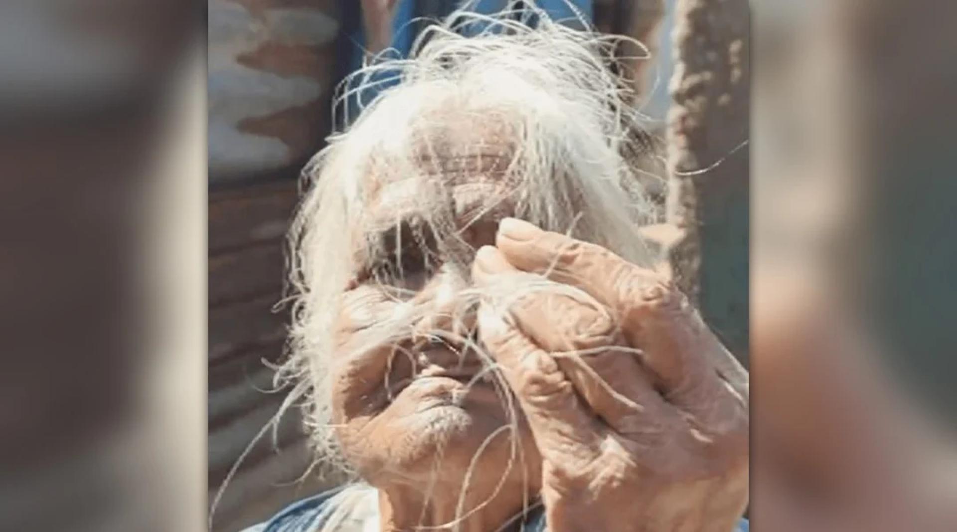 一名婆婆接受访问表示，她在上周开始莫名其妙地严重脱发，只要用手轻轻一捋，发丝便从头皮甩掉。