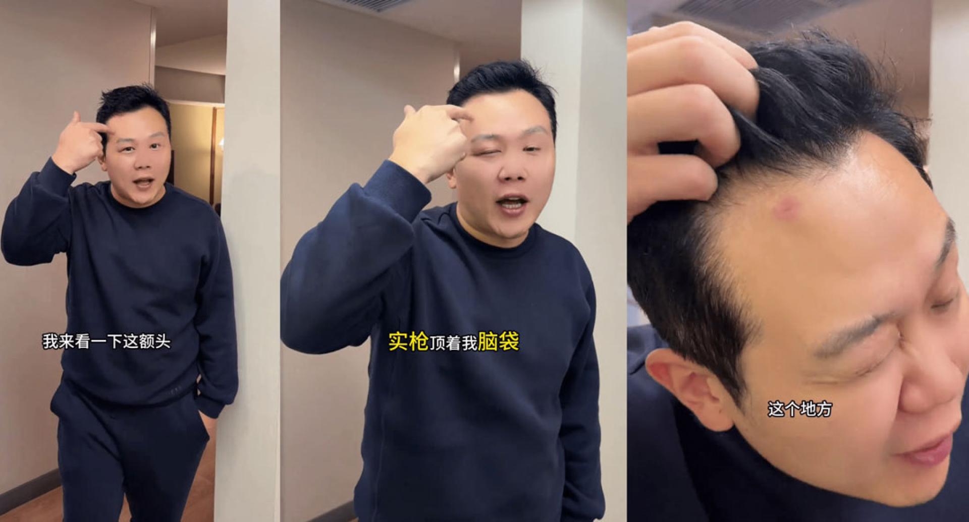 王嫌球迷在社媒发布影片，画面显示他的额头因被枪械抵压，留下清晰的红色压痕。