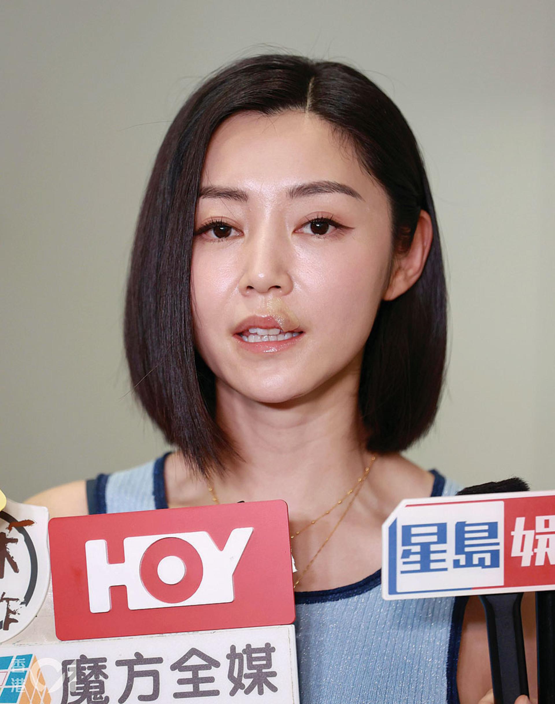 由于卫诗雅嘴上伤口未愈，因此暂时要避免大笑、嘟嘴等动作。